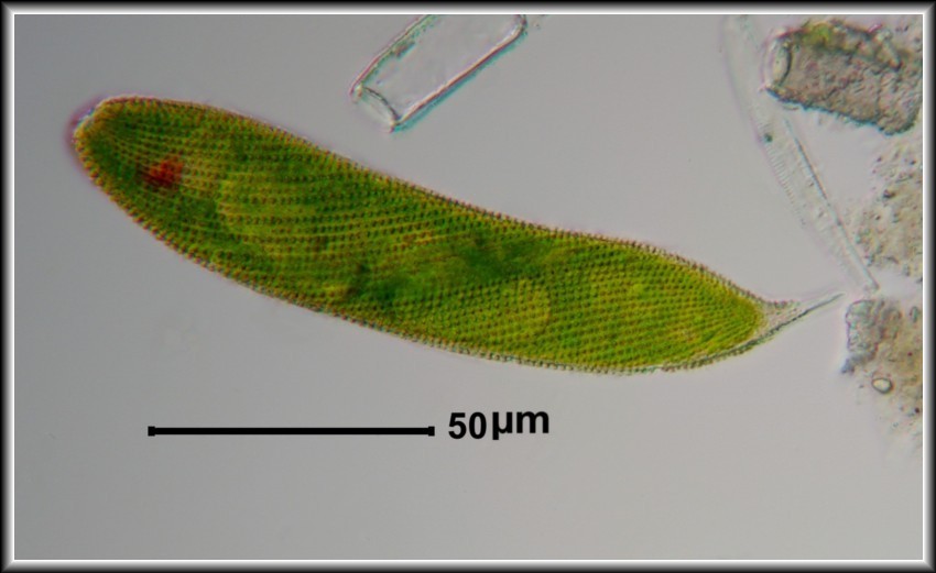 Foto 4 - Euglena spirogyra